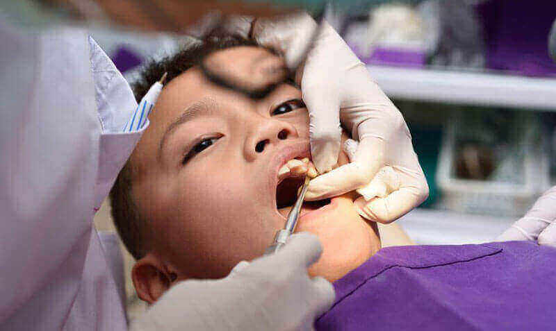 Tooth Extractions Leduc